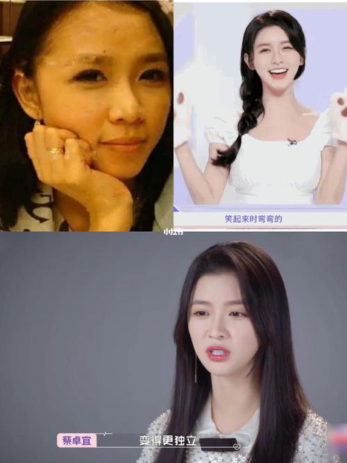 笑眼女孩蔡卓宜的整商之路_整容_歌手_蔡卓宜_娱乐_明星娱乐资讯