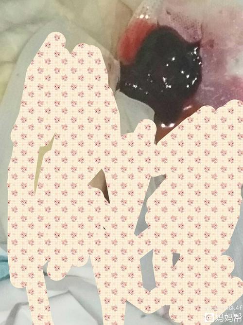 胚胎不长了,上午做的人流,下午