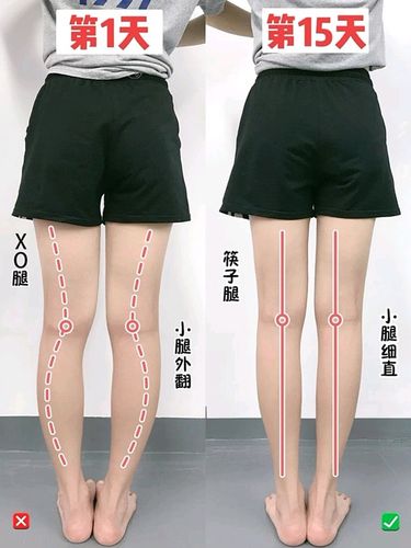 4个动作改善小腿外翻练出细直漫画腿