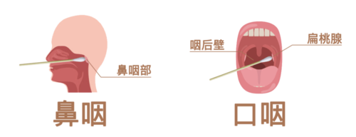 核酸检测前注意事项及如何配合医护人员做核酸检测