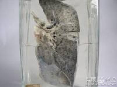 肺结核咳痰要怎么办