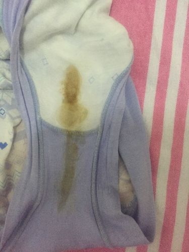 这个颜色的白带什么问题啊?好担心