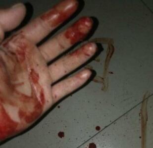 是怎么回事啊? 鼻子出血