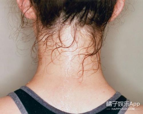一动就大汗淋漓,头颈部出汗居多,或是阴虚合并湿热,如何调理?