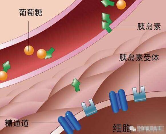 胰岛素分泌不足将产生什么