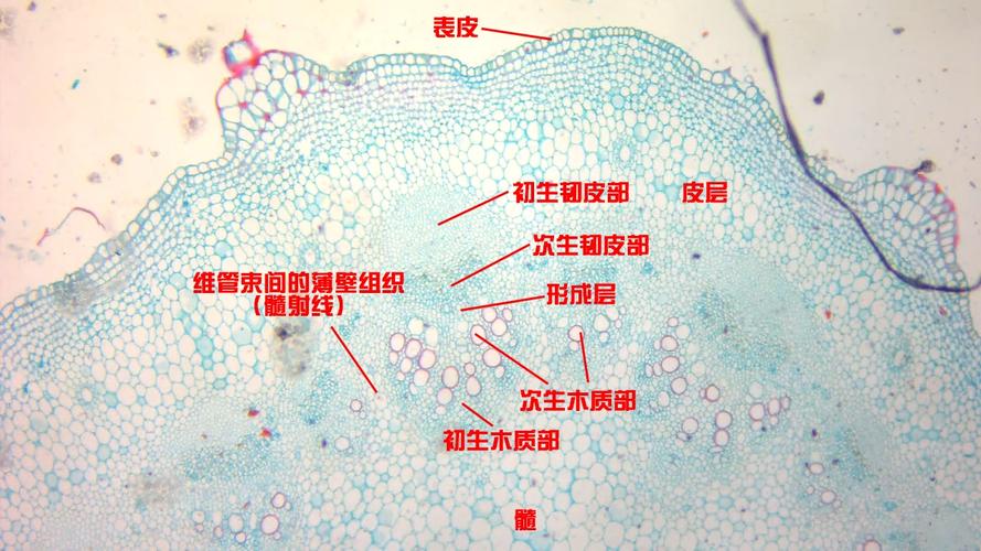 向日葵老茎横切面(次生结构)