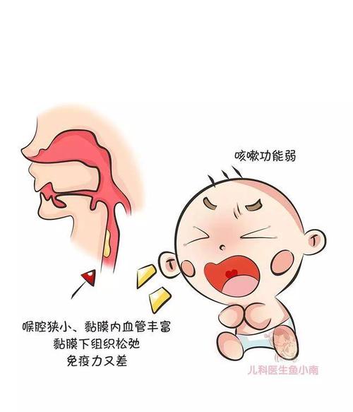 小儿急性喉炎的病情往往比成人严重,如果不及时救治,还会有窒息死亡的