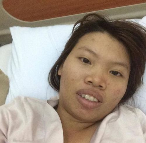 21岁女子花10万元整容,从丑女蜕变成美女,还嫁给了富二代