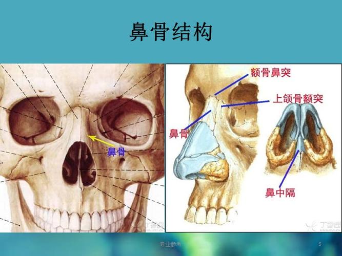 鼻骨骨折#专业参考