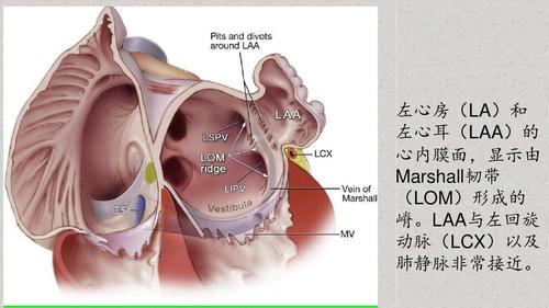 病例分享—左心耳血栓