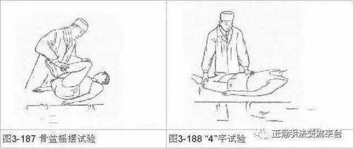 骨盆挤压试验:用于诊断骨盆骨折和骶髂关节病变.