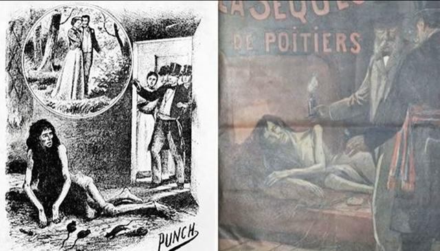 法国贵族小姐被母亲囚禁25年睡在自己的排泄物中获救时仅50斤