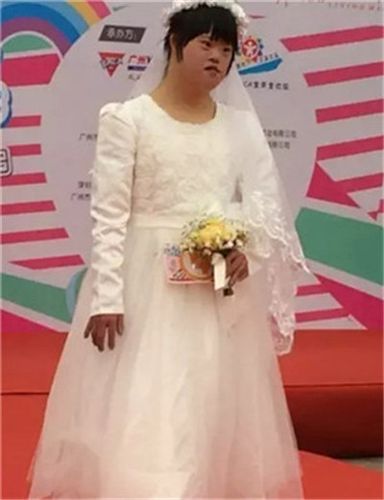 唐氏儿的样貌图片 (46)