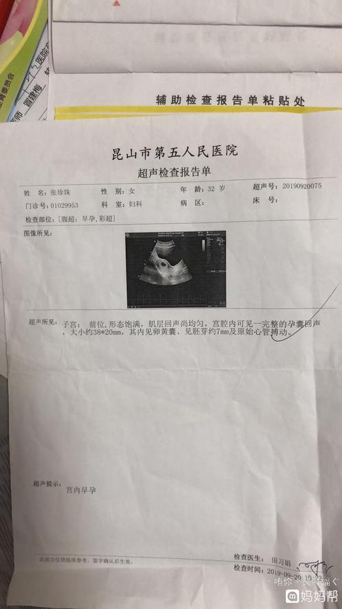 谁能看出我这孕囊是什么形状,50天孕囊