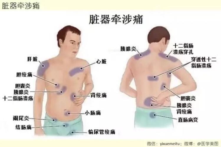 身体疼痛对应脏器疾病