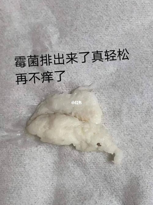 说舒服很多,也不痒了,还说认识我太晚了,女人私