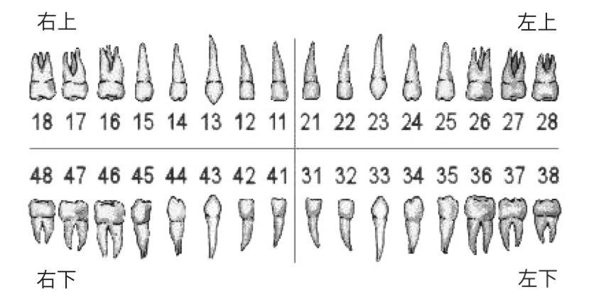 24.35 三颗正畸牙,加上一颗只剩残根的 46 ,以及 18.28.