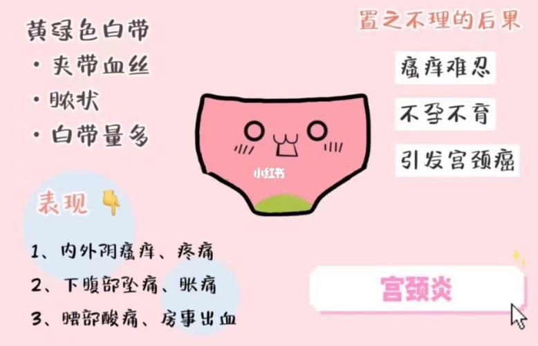 黄绿色白带:宫颈炎 严重可至—极度瘙痒,不孕不育,宫颈癌变74_宫颈