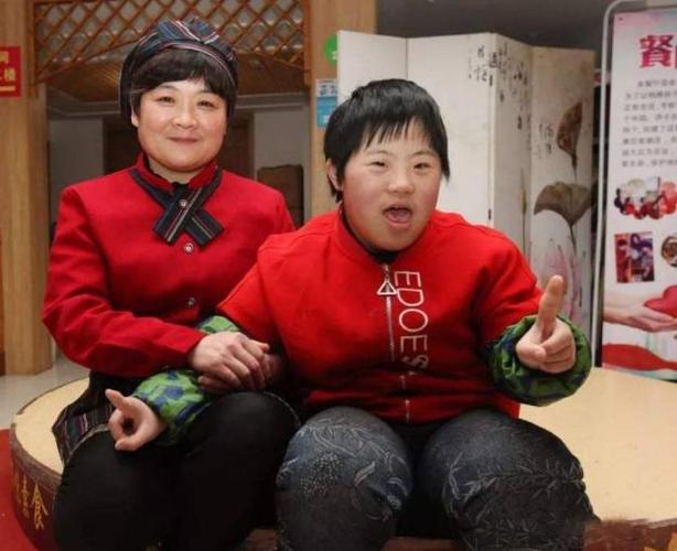 为什么患唐氏综合征的人没有遗传父母的外貌长相都极其相似