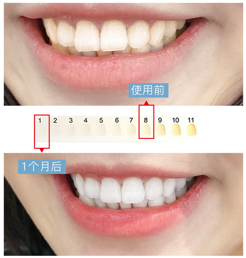 人没老牙却坏掉了做好这点牙口好吃嘛嘛香