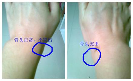 右手腕内侧,大拇指往下至手腕处骨头突出,手腕转动幅度大的时候,突出