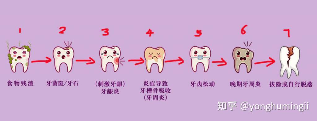 牙疼的搜索