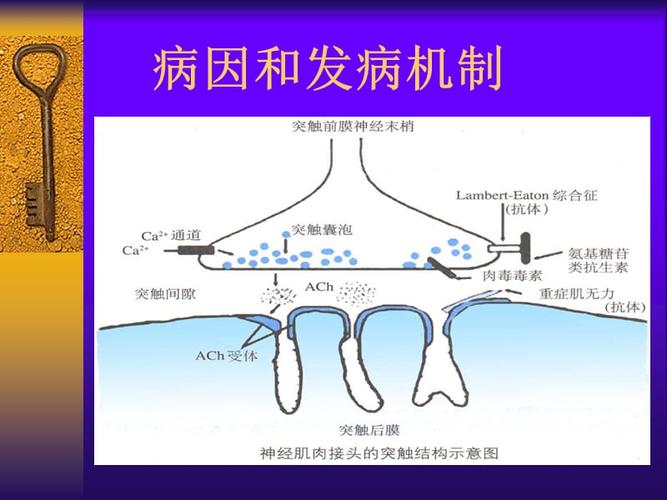 重症肌无力,周期性瘫痪.ppt