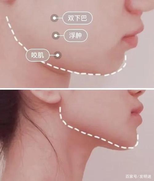 坚持使用,松弛的下巴也变得紧实了,双下巴明显小很多,下颚线条越发