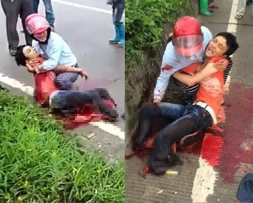 【接力】潮南车祸中的15岁学生再次做截肢,急需各方捐助!