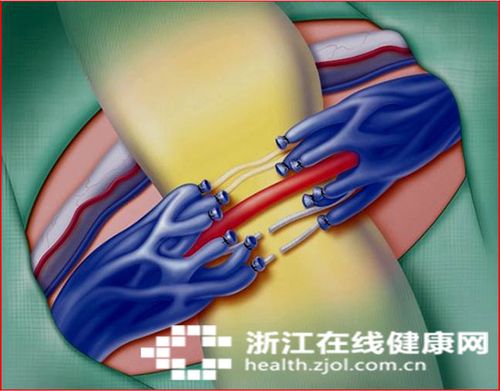 苦求二胎不得睾丸却多了一个 是男性不育头号杀手作怪