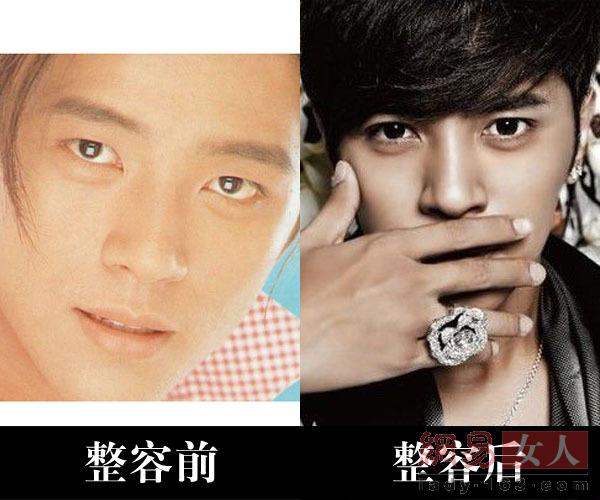 死鱼眼变电眼男的典范
