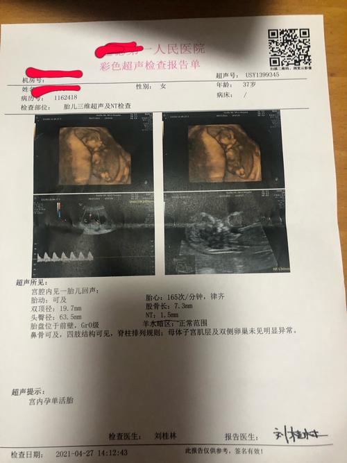 nt顺利通过,已知男宝!