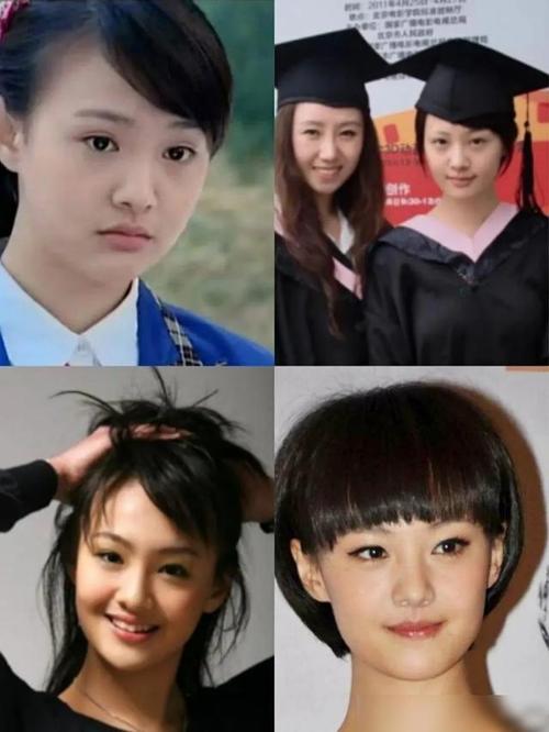 女明星的"变脸史":郑爽早期像初恋女神,金晨判若两人