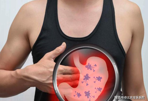 警惕!8成胃病患者忽略了胃癌早期症状