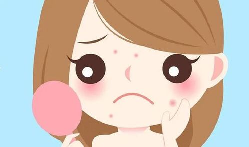 你一直都错了脸上长痘是因为熬夜吗