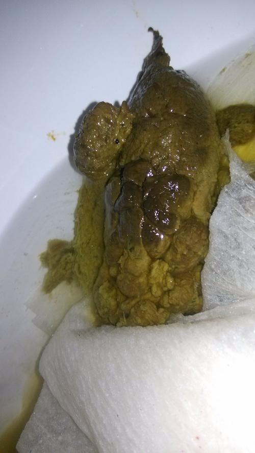这样大便颜色正常吗?
