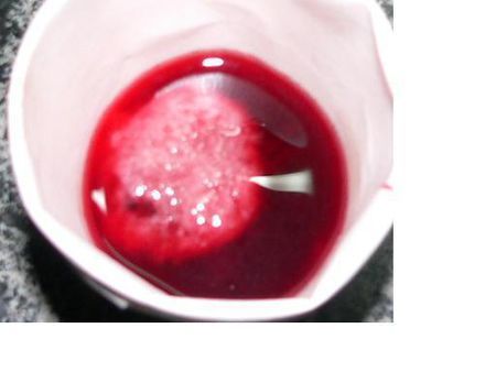 药物流产排出的胚胎图片是什么样