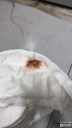 怀孕5周第35天,看见了很小的孕囊,hc