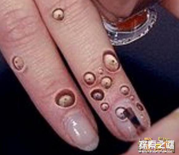 莲蓬乳和空手指网络上最恶心的图片(胆小勿入)