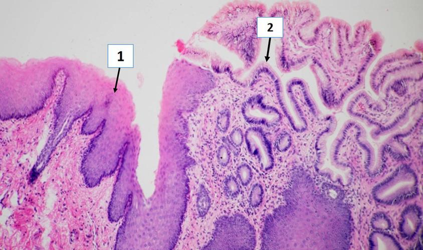 616961图中是子宫颈与阴道连接部的切片图,观察上皮组织的形态