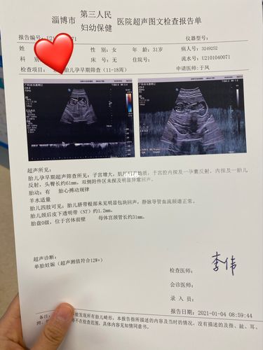 nt秒过7815附淄博市妇幼保健院建档须知_建档_产检_胎儿_孕期日记