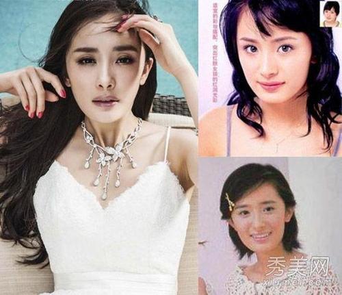 李小璐晒照被吐槽 揭明星整容前后惊悚对比照