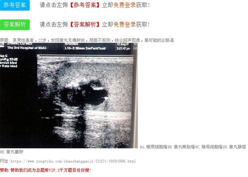 睾丸畸胎瘤 c.精母细胞瘤 d.睾丸腺癌 e.睾丸囊肿