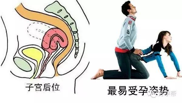 女性子宫后位,咋备孕呢?