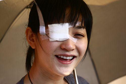 纱布包眼美女图 查杰