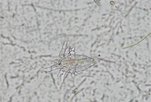 显微镜下的大世界--浮游生物|轮虫|衣藻|伸缩_新浪网