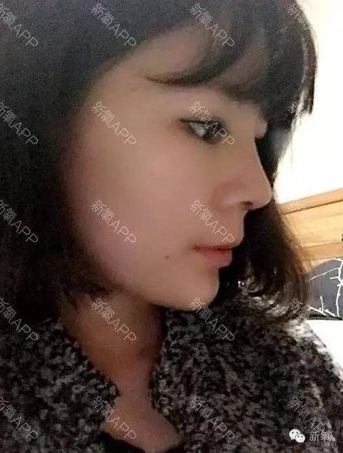 女明星们最爱用做猪鼻子来证明自己没隆鼻?