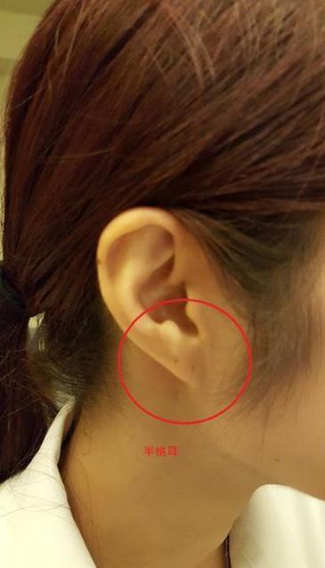 教你从耳朵看相注定富贵一生的面相