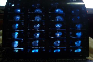手部ct,花了我210大元