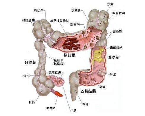 对于这些高直肠肿瘤结直肠结直肠癌直肠肿瘤的症状直肠腺瘤直肠结构